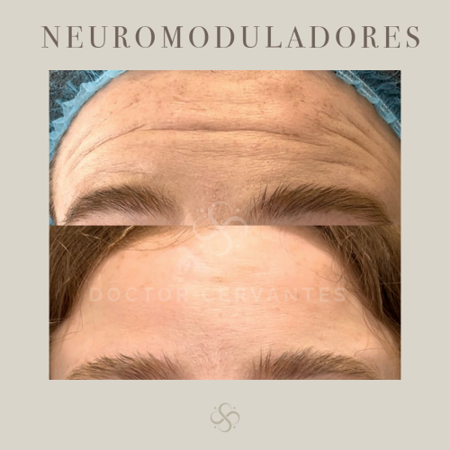 neuro-1