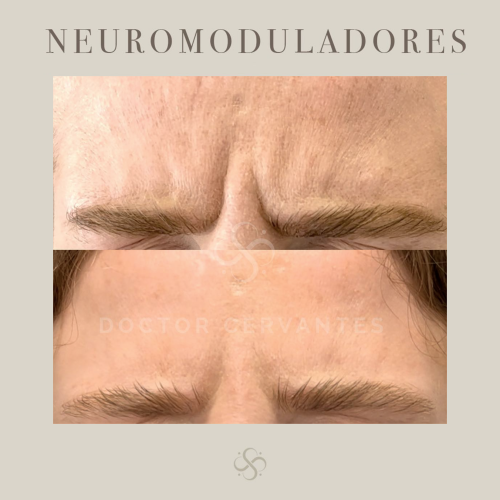 neuro-2