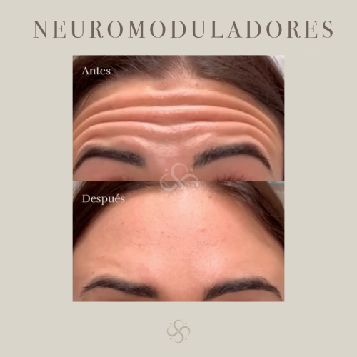 neuro-3
