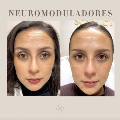 neuro-4